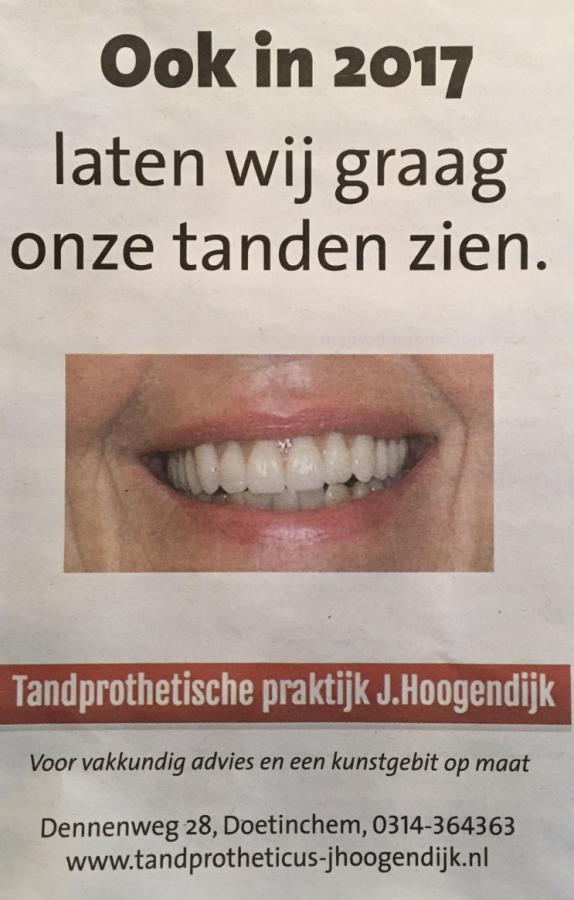 Tandtechniek in Doetinchem, Implantoloog nabij Zevenaar, immediaatprothese regio Bronckhorst